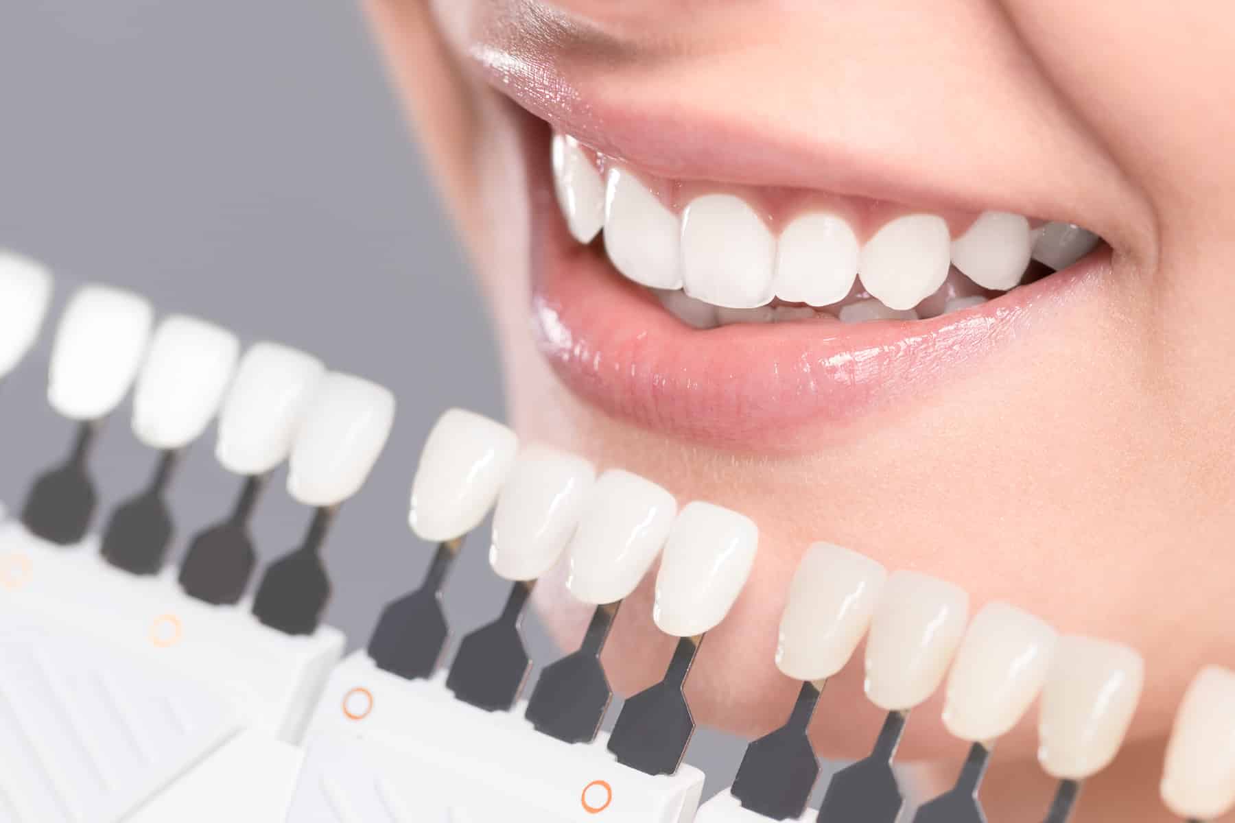 get your restorative dental bridges from Hearthside Dentistry in Thornton CO