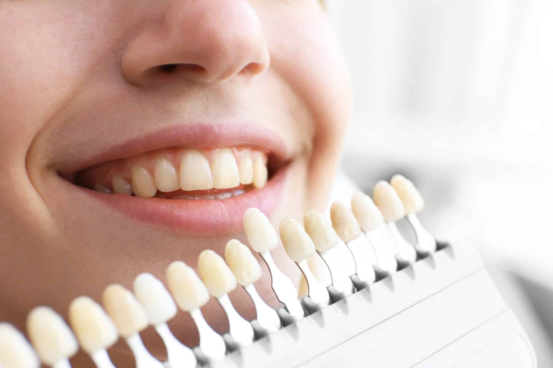 Dental bonding in Thornton, CO from Hearthside Dentistry