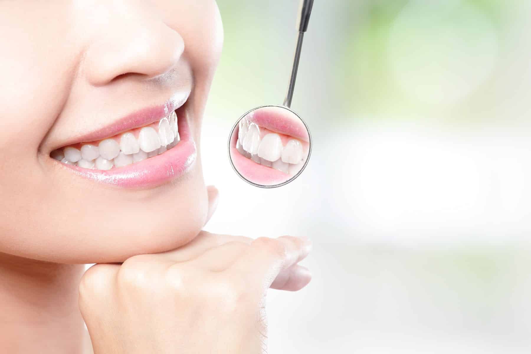 Dental veneers in Thornton, CO from Hearthside Dentistry