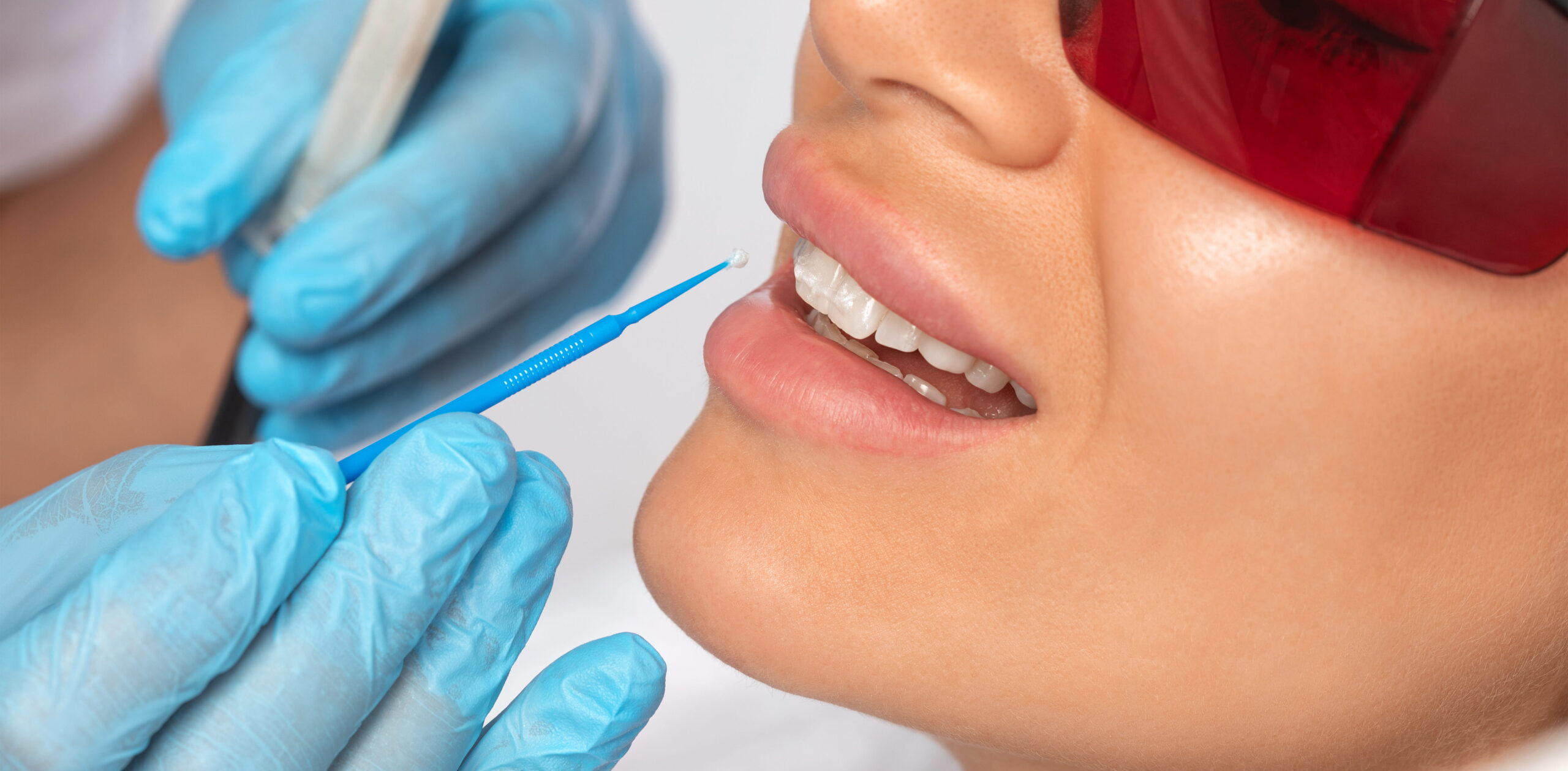enamel remineralization in thornton, CO